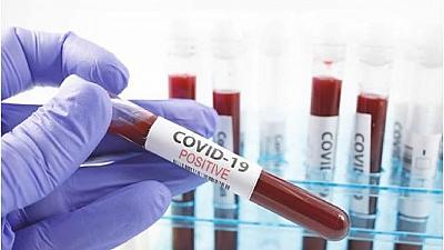 Article : Covid-19 : Une opportunit&eacute; pour la RDCongo et sa jeunesse