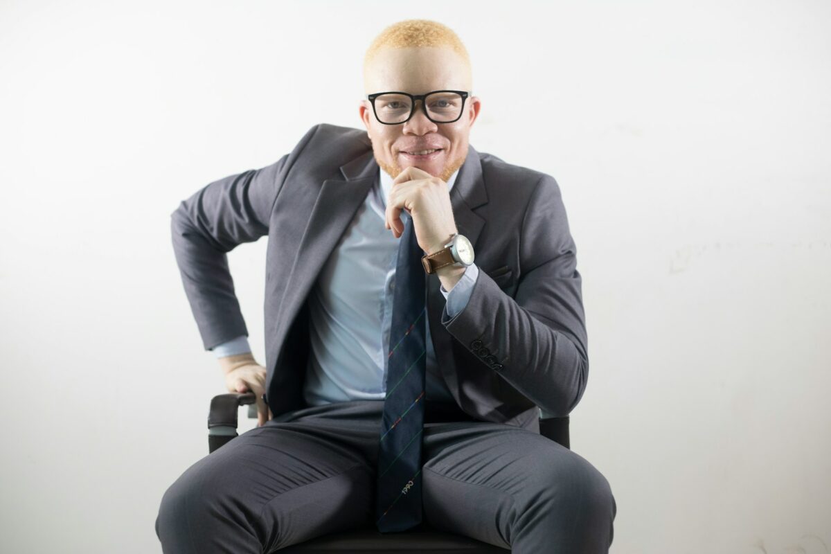 Article : Les albinos : entre stigmatisation et croyances dangereuses